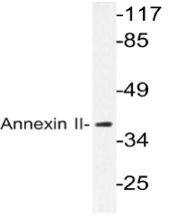 AP20666PU-N - Annexin A2 / ANXA2