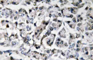 AP20671PU-N - Interleukin-11 / IL11