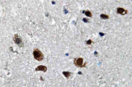AP20673PU-N - SCN2A