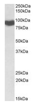 AP21520PU-N - Cytochrome P450 Reductase