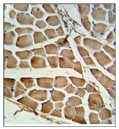 AP17920PU-N - CARD4 / NOD1