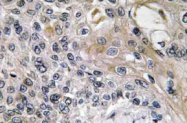 AP20679PU-N - Netrin-1