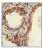AP17243PU-N - CREB3L1 / OASIS