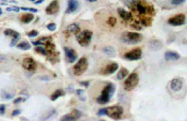 AP20684PU-N - FOXO4 / AFX1 / MLLT7
