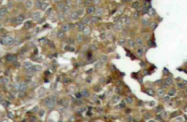 AP20685PU-N - Cofilin-1