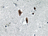 AP20660PU-N - Lamin-B1 (LMNB1)