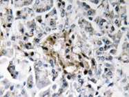 AP20659PU-N - Insulin