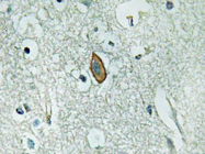 AP20653PU-N - KCNMA1