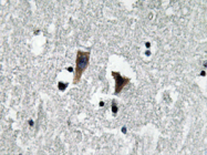 AP20650PU-N - Amine Oxidase A / MAOA