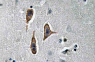 AP20587PU-N - Nephrin