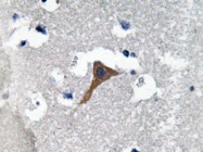AP20646PU-N - Cathepsin H