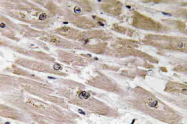 AP20597PU-N - BMP2 / BMP2A