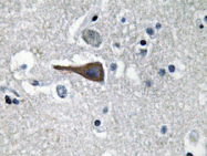 AP20643PU-N - Cholecystokinin / CCK