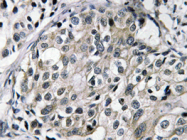 AP20640PU-N - HIV Tat-specific factor 1 / HTATSF1
