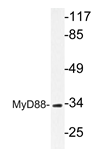 AP20639PU-N - MYD88