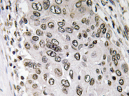 AP20637PU-N - Annexin A3 / ANXA3