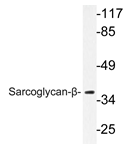 AP20636PU-N - SGCB (Beta-sarcoglycan)