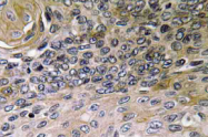 AP20603PU-N - Interleukin-8 / IL8