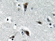 AP20631PU-N - RFC3 / RFC38
