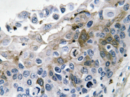 AP20628PU-N - Interleukin-1 beta / IL-1B