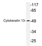 AP20626PU-N - Cytokeratin 13