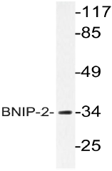 AP20607PU-N - BNIP2