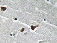 AP20625PU-N - SERPINE1 / PAI1
