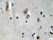 AP20622PU-N - Cytokeratin 14