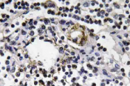AP20609PU-N - IFNG / Interferon gamma