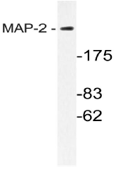 AP20610PU-N - MAP-2