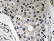 AP20617PU-N - Leptin