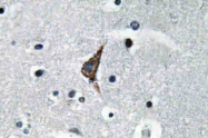 AP20612PU-N - CD284 / TLR4