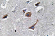 AP20613PU-N - Interleukin-12 alpha / IL12A