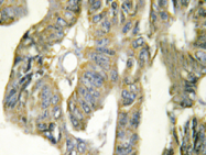 AP20373PU-N - Tumor necrosis factor (TNF-alpha)