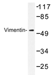 AP20372PU-N - Vimentin