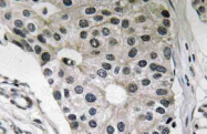 AP20617PU-N - Leptin