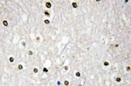 AP20512PU-N - Tumor protein p73 (TP73)