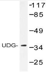AP20519PU-N - Uracil-DNA glycosylase 2 / Cyclin-O