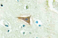 AP20527PU-N - Ephrin-A5