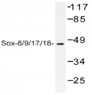 AP20530PU-N - SOX8/9/17/18