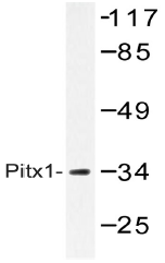 AP20531PU-N - PITX1
