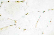 AP20533PU-N - SMAD1