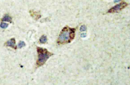 AP20537PU-N - RPS6KA6 / RSK4