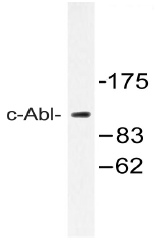 AP20540PU-N - ABL1