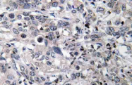 AP20543PU-N - CYP2C19