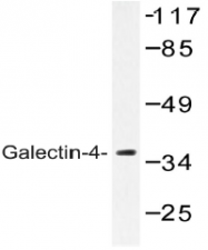 AP20547PU-N - Galectin-4
