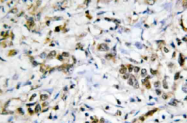 AP20547PU-N - Galectin-4