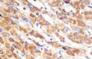 AP20556PU-N - Galectin-7