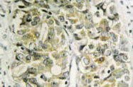 AP20558PU-N - Galectin-8