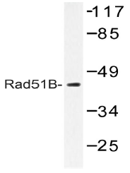 AP20559PU-N - RAD51L1